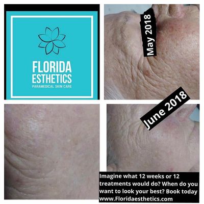 Florida Esthetics